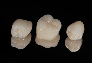 Closeup of three dental crowns on black background