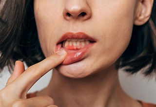 Close up of woman showing swollen gums needing gum disease treatment in Owasso, OK