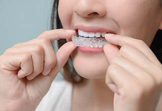 Closeup of woman putting clear aligners on teeth